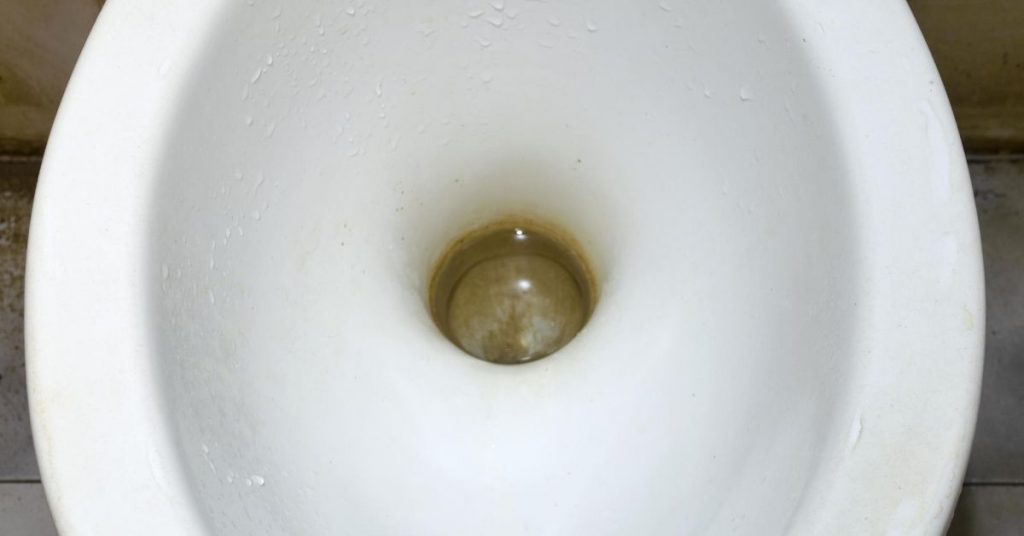 brown staining in loo - How to clean a very stained toilet bowl